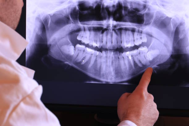 Best Emergency Treatment for Toothache in Shiprock, NM